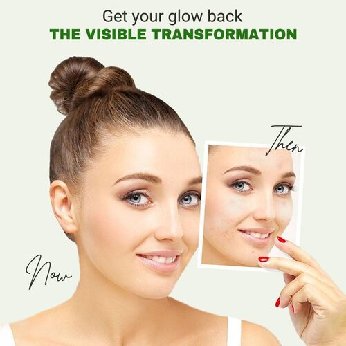 Beauty of Joseon Light On Serum : Centella + Vita C 30ml — product image 6