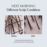 GROWUS Damage Therapy Scalp Scaling Ampoule 50ml — product view 7