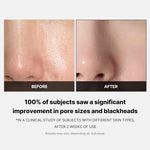 MEDICUBE Zero Pore Pad 2.0 (70ea) — product image 5