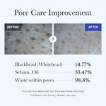 MEDICUBE Zero Pore Blackhead Mud Mask 100g — product image 5