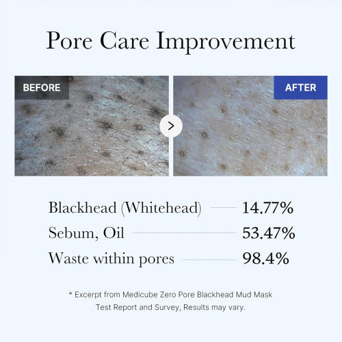 MEDICUBE Zero Pore Blackhead Mud Mask 100g — product image 5