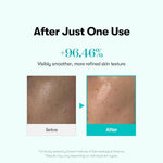 VT PDRN Glow Ampoule Mist skin-texture comparison artwork with before-and-after photographs