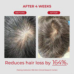 moev Annurcatin Shampoo 525ml — gallery view 3