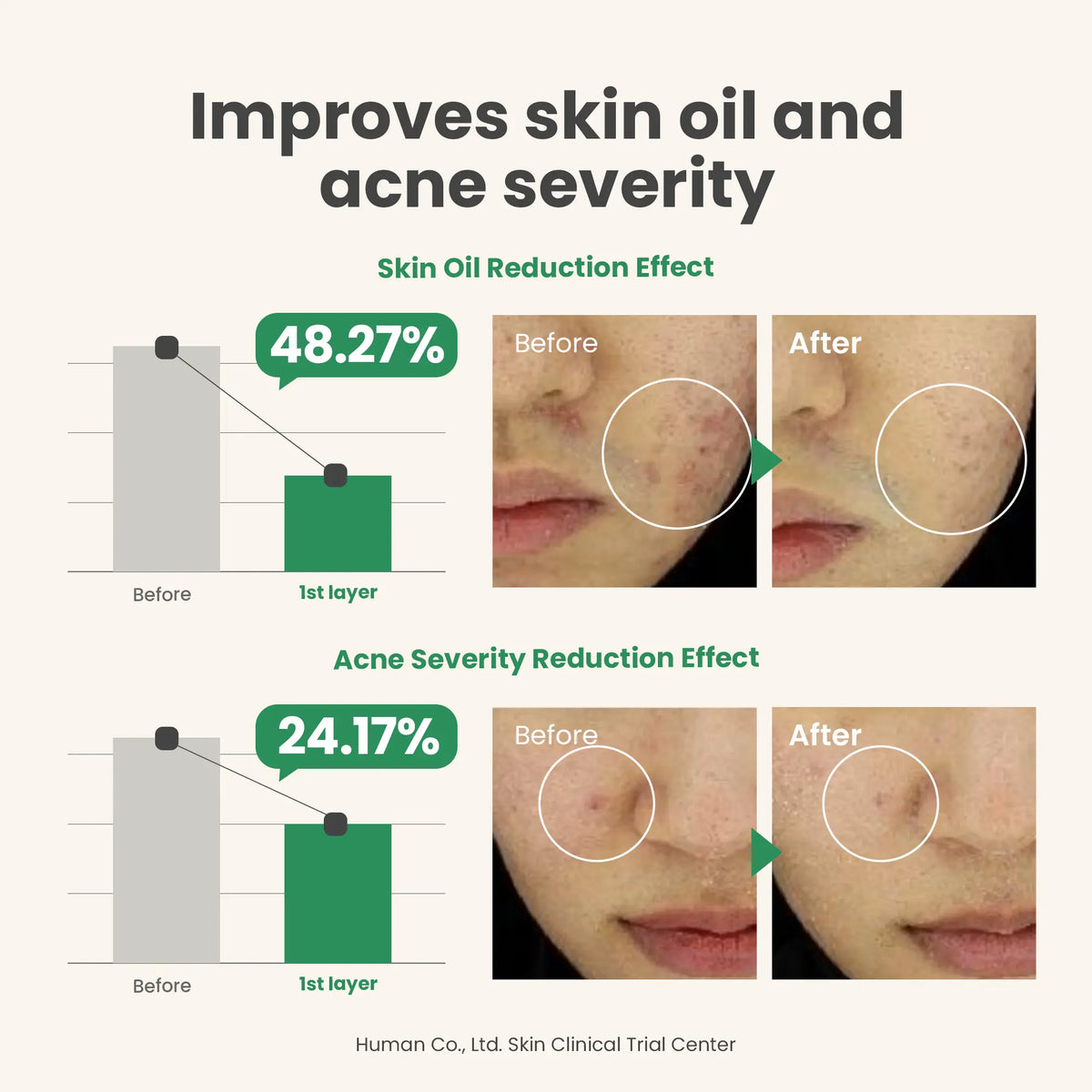 AXIS-Y Spot the Difference Blemish Treatment 15ml — gallery view 5